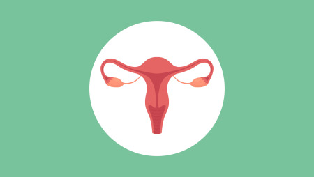 Polycystic Ovary Syndrome (PCOS) and Fertility: What You Need to Know