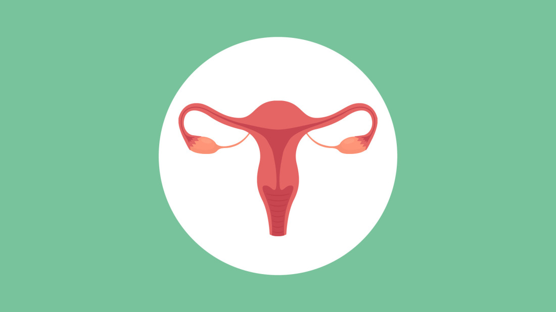 Polycystic Ovary Syndrome (PCOS) and Fertility: What You Need to Know